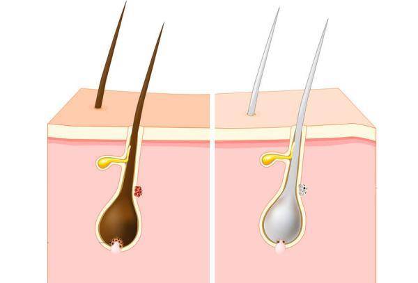白头发会不会"拔一长十"?_毛囊_黑色素_陆威