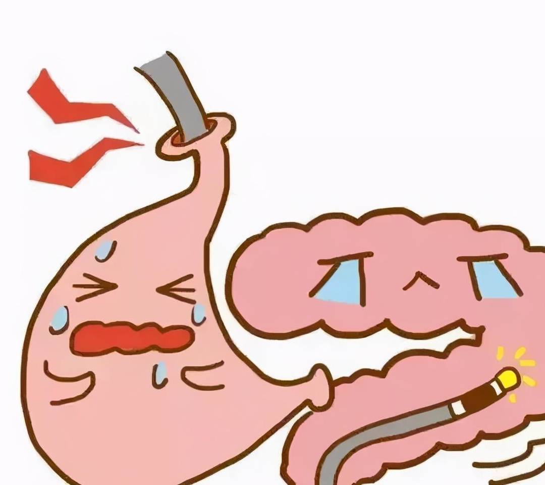 检查_王大姐_胃镜