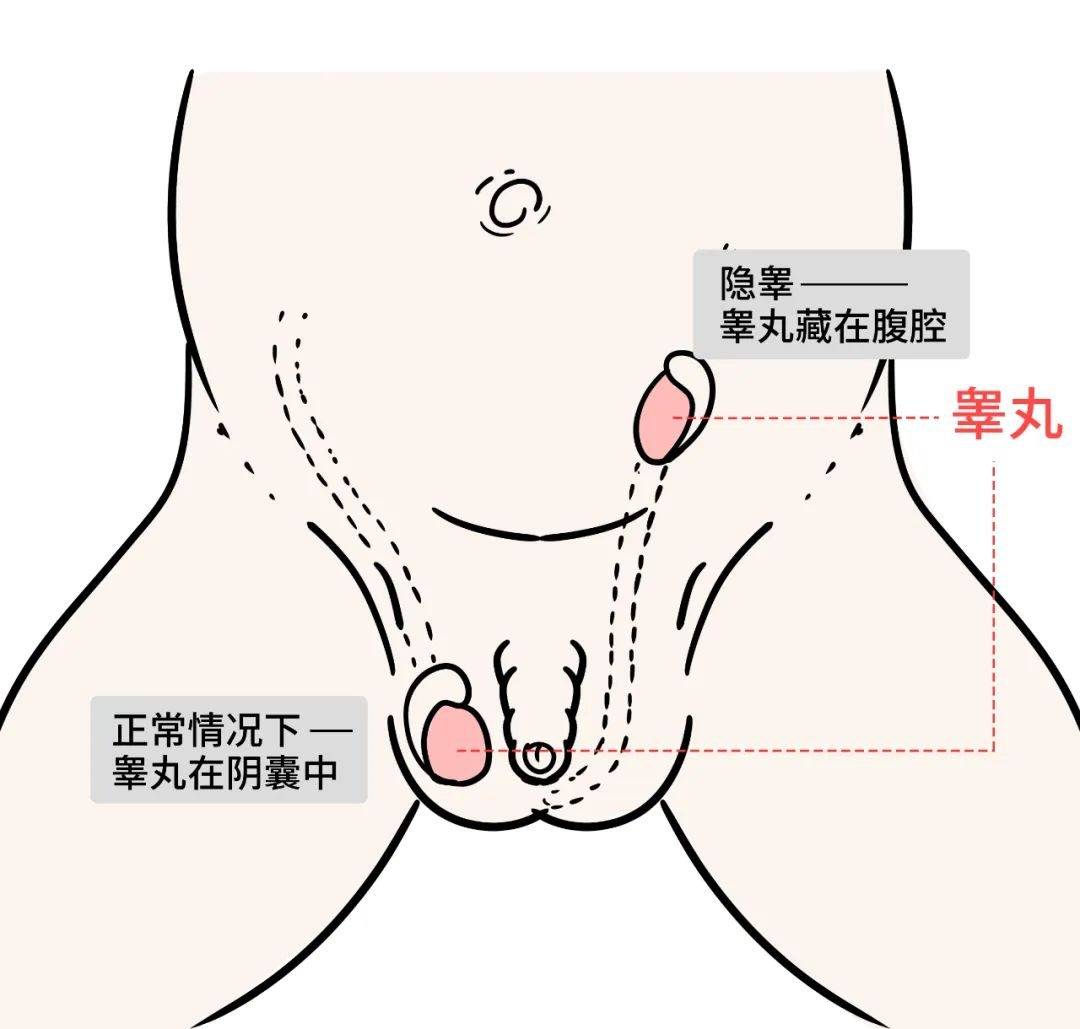 一周宝宝睾丸正常图片图片