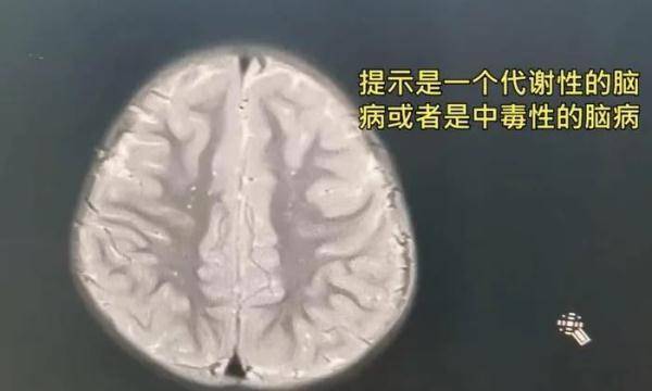 父母抹酒精退烧致4岁女儿住进ICU 宝宝发烧科学处理方法