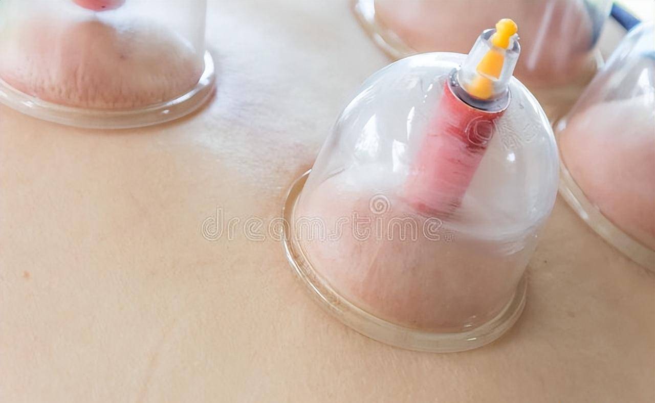 13,刺血拔罐吸出的时尚,可表现出不同的病情.