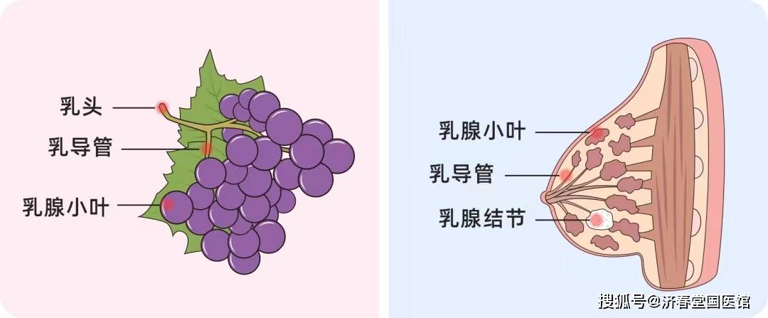 济春堂中医：查出乳腺结节选中医还是西医？什么办法可以彻底消除结节？