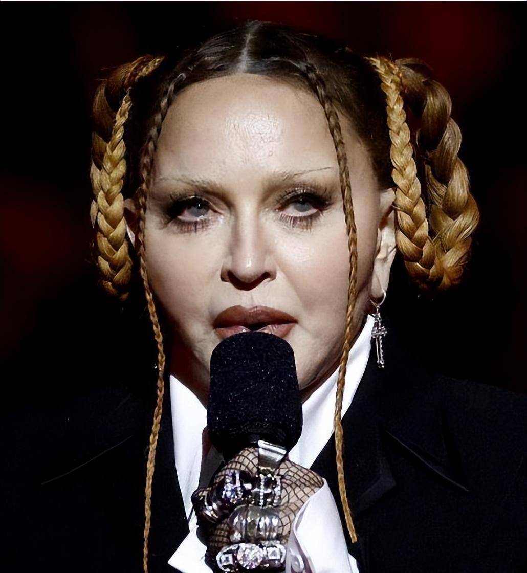 64岁麦当娜受舆论压力 决心做手术改掉整容脸 恢复自然美_变化_媒体