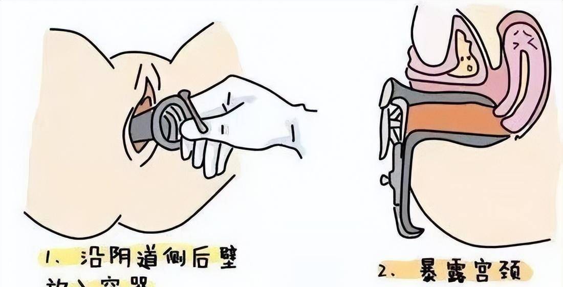 让人脸红的"妇科检查",到底是咋进行的?检查注意啥?
