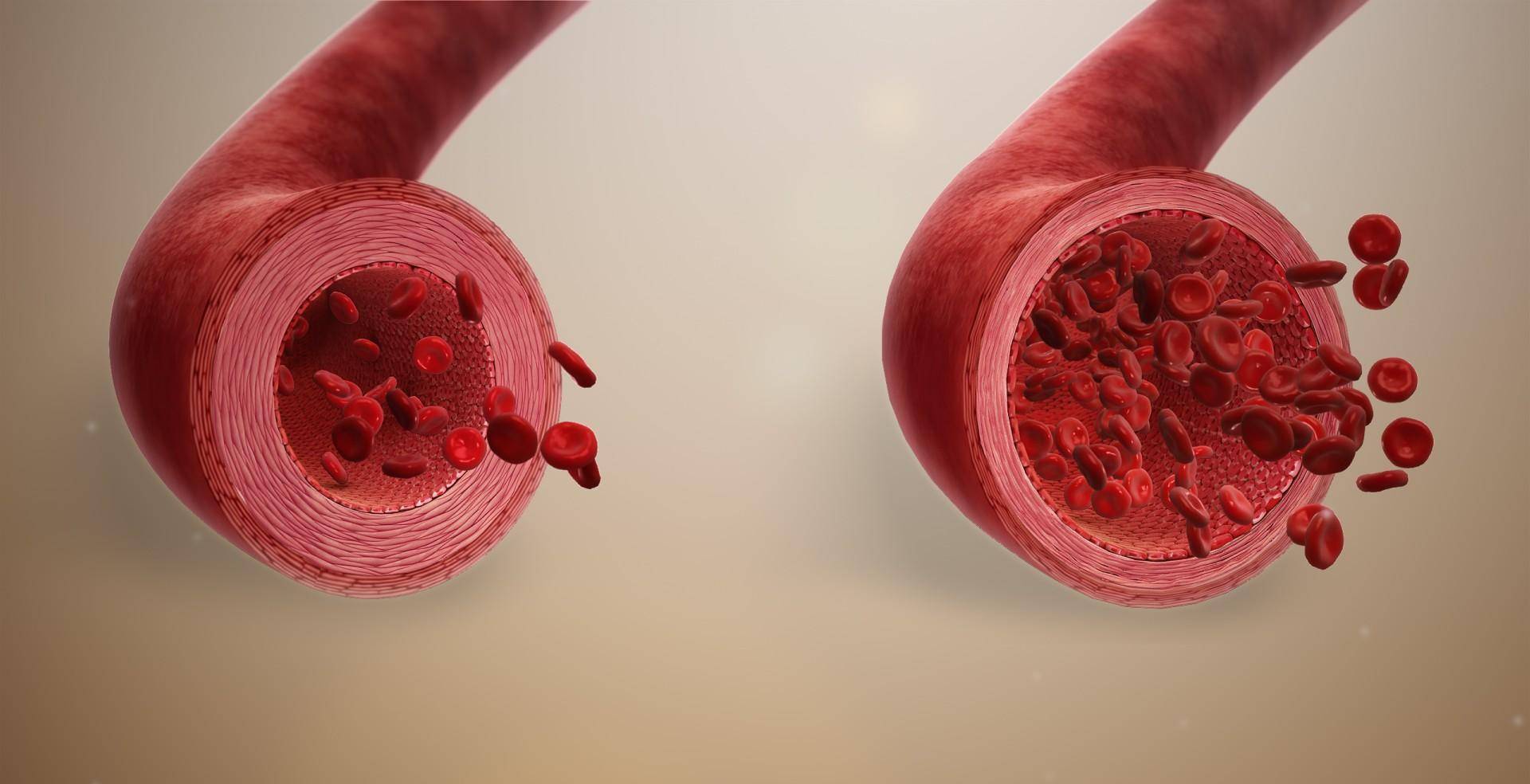 老年高血压,"脉压差大"是一大矛盾!有何危害?又该怎样控制?