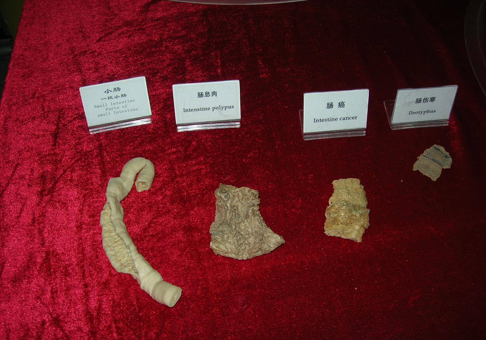 真实人体标本展示,你没见过的畸形和病灶结构_男性_审核_内脏