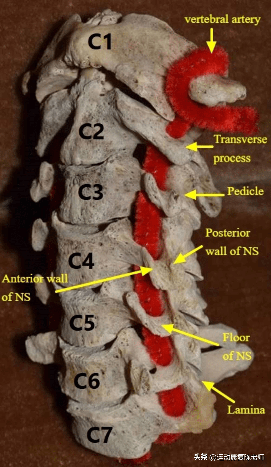 第六颈椎横突结节图片图片