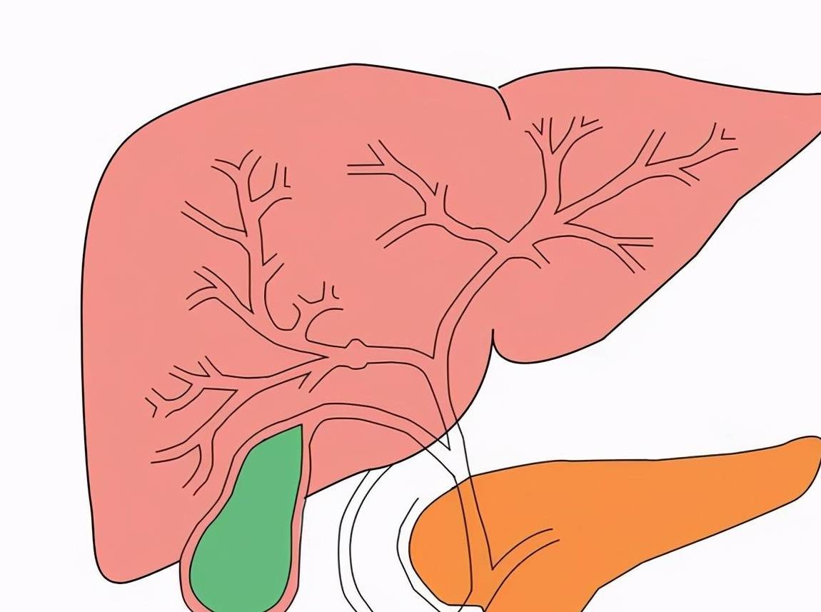 其实,不是所有胆都要切_胆汁_胆固醇_食物