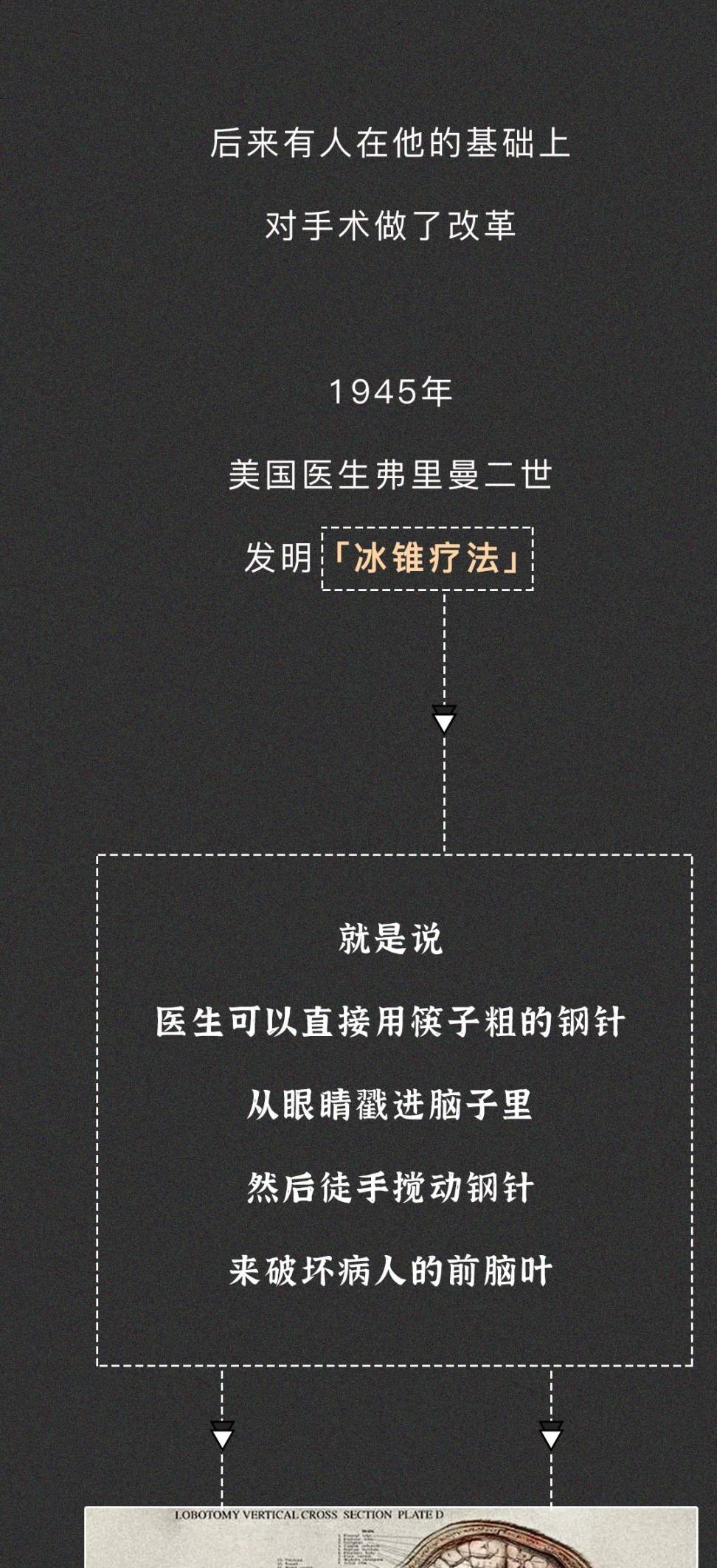 tips:1其實很多電影裡都暗戳戳地提到過這個腦葉白質切除術,小李子演