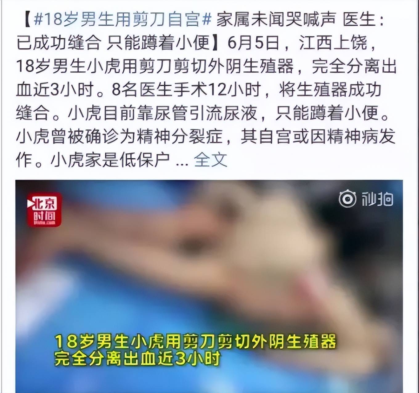 小男孩做变性手术惩罚图片