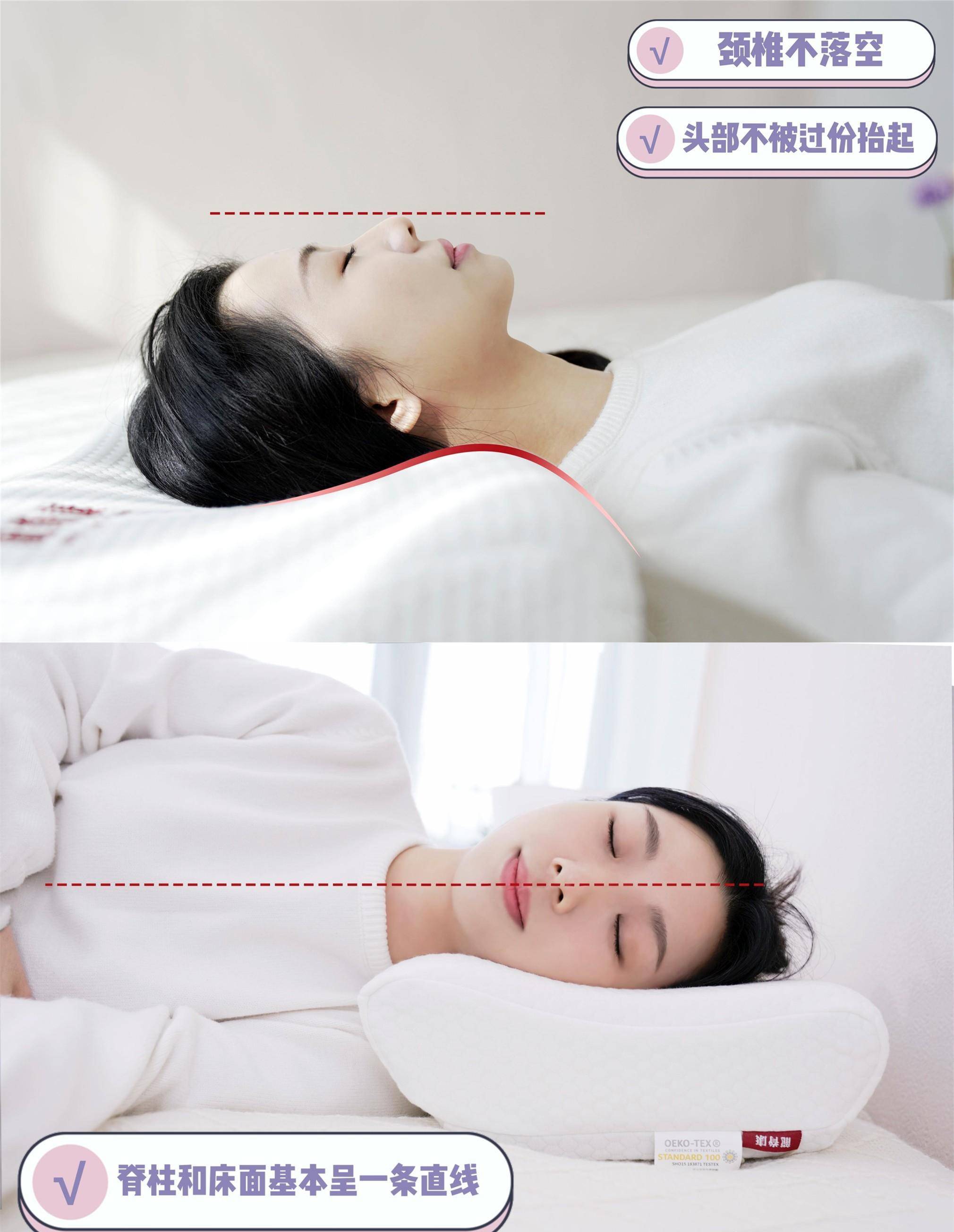 脖子上的"富贵包",如何消除?