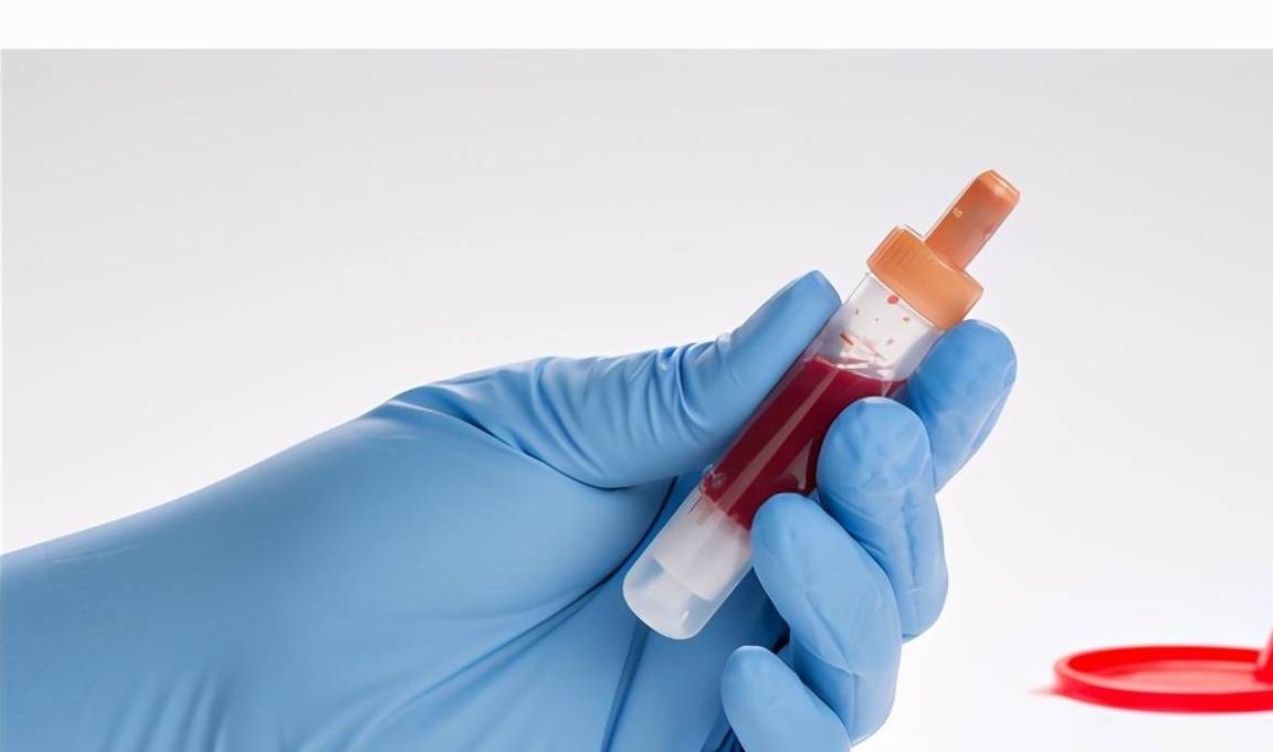 男子因错误使用二甲双胍,导致糖尿病乳酸性酸中毒,这错咱不能犯_先生