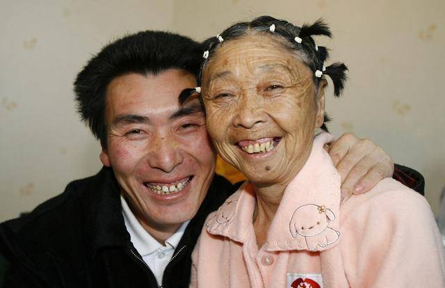 为嫁25岁小伙,60岁老太马玉琴做整容手术,如今夫妻二人过得怎样