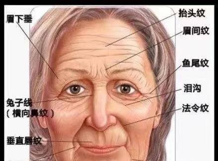 面部都有哪些皱纹,该如何解决?_静态_效果_位置