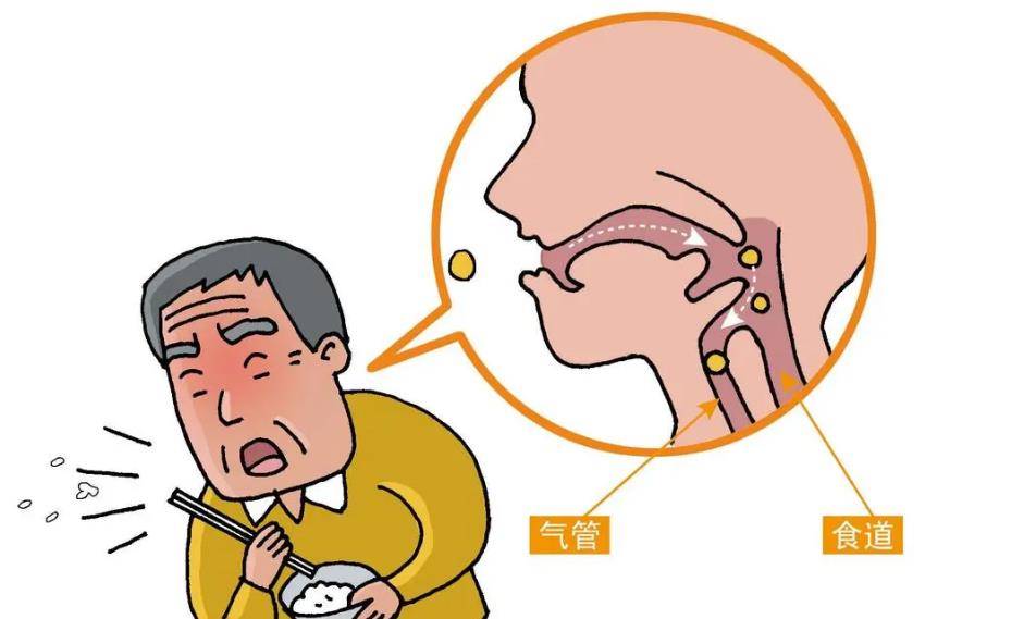 可能是食道病上身_食管_患者_情况