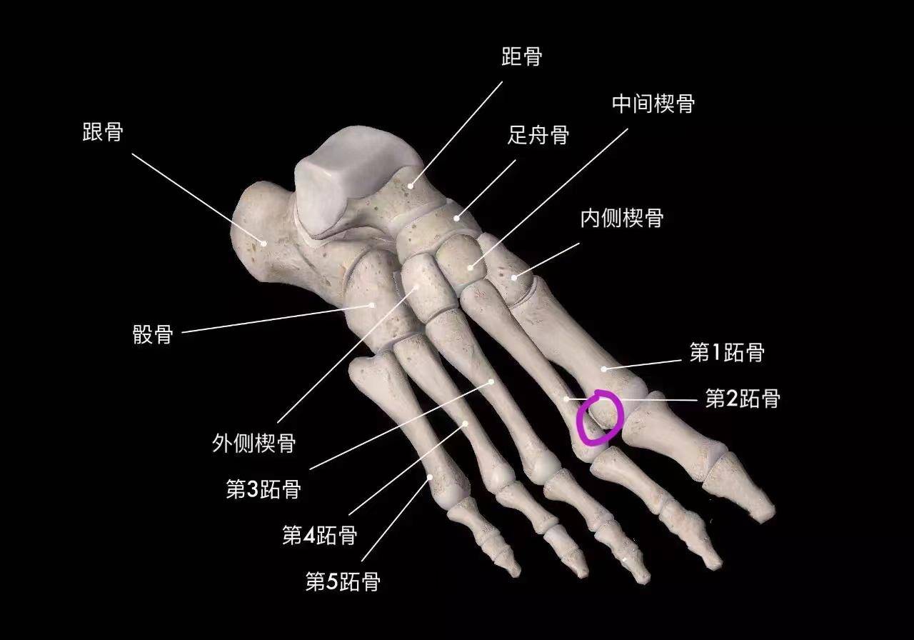 跖骨头是什么位置图片图片