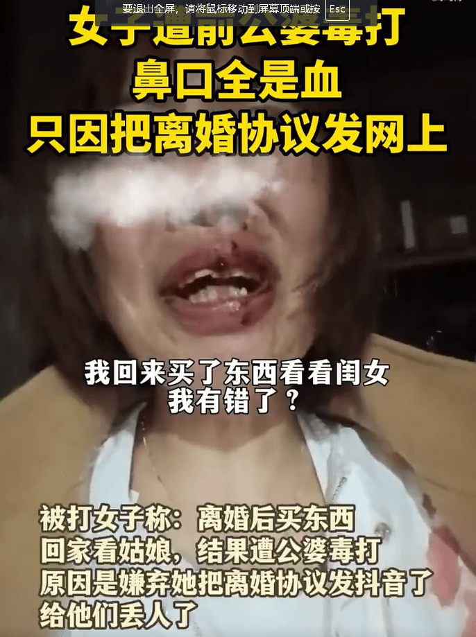 女子把离婚协议发网上遭前公婆殴打,原因竟是给他们丢人了