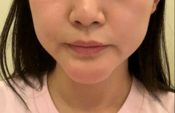 科普:生长因子取出系统治疗,你需要分3步走_组织_手术_控制