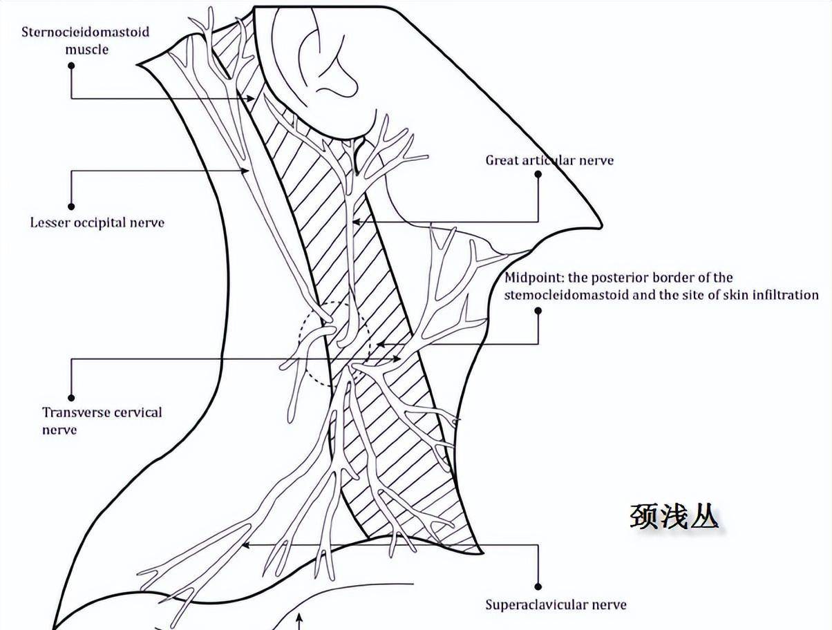 颈深丛阻滞为什么能治疗头痛