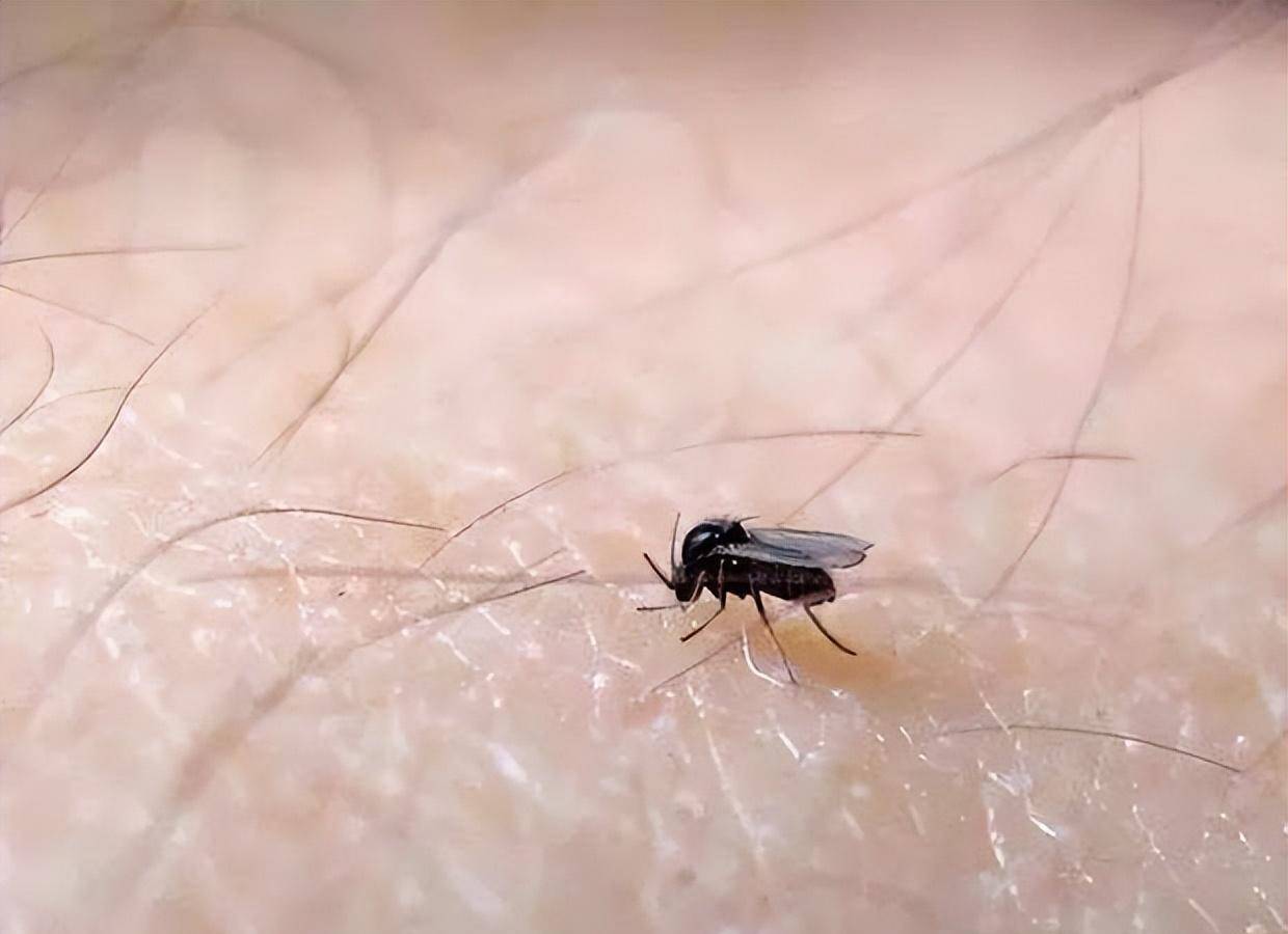 尽管蠓虫叮咬通常只导致短期的瘙痒和不适,但在某些情况下,它们可能