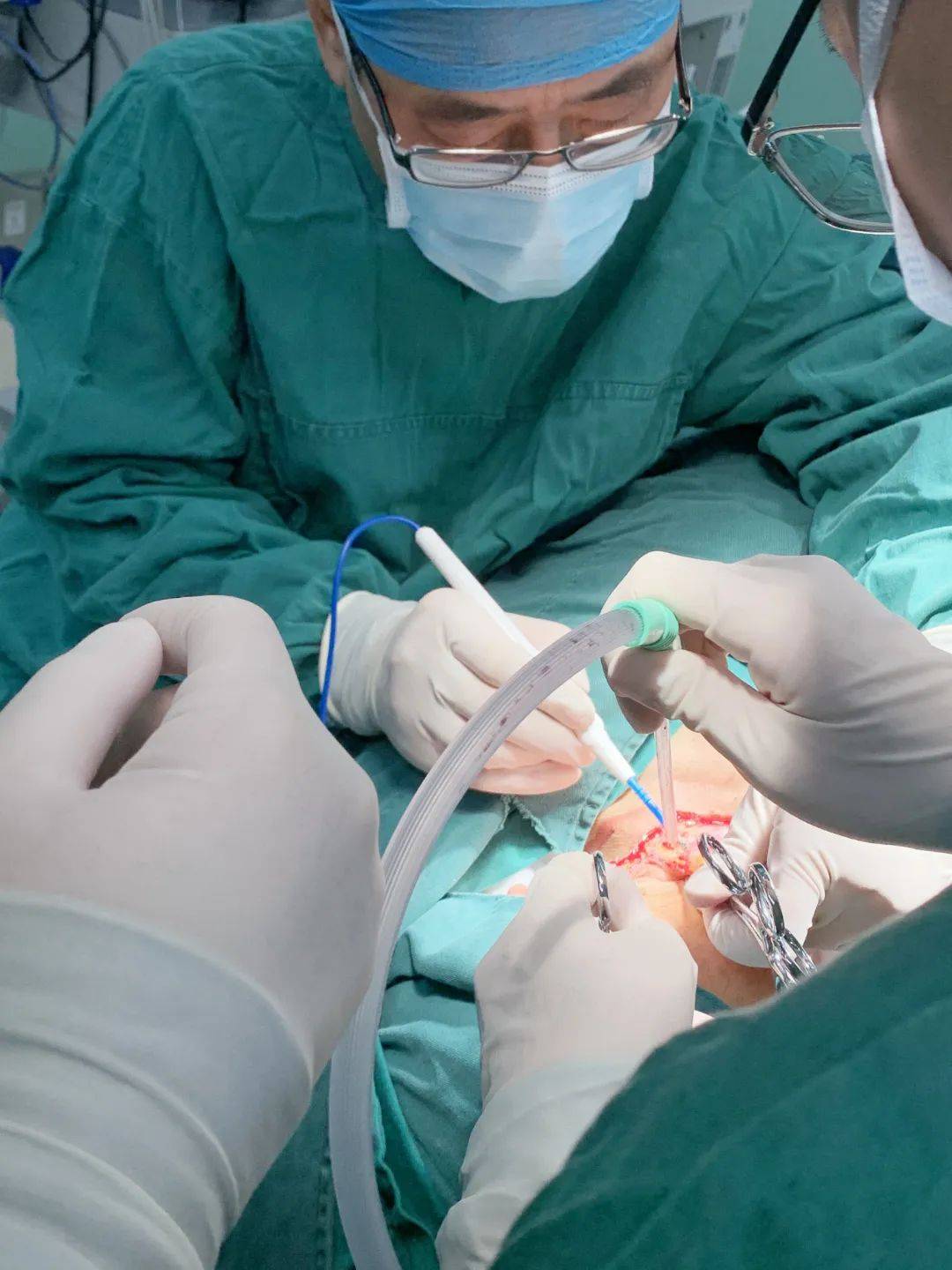 甲状腺癌侵犯喉部,泰兴市人民医院这个科室团队妙手除之_手术_患者