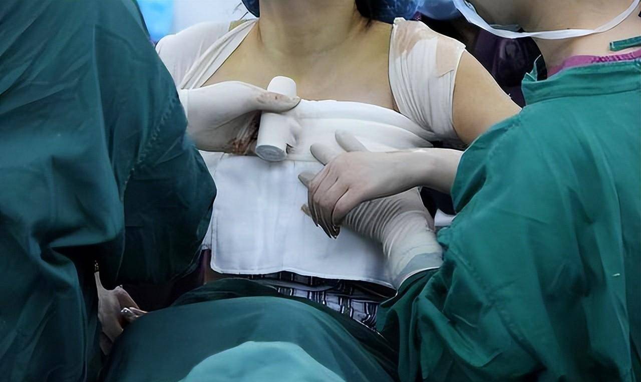 女子花7.8万隆胸术后焦虑自卑 隆胸手术有哪些风险