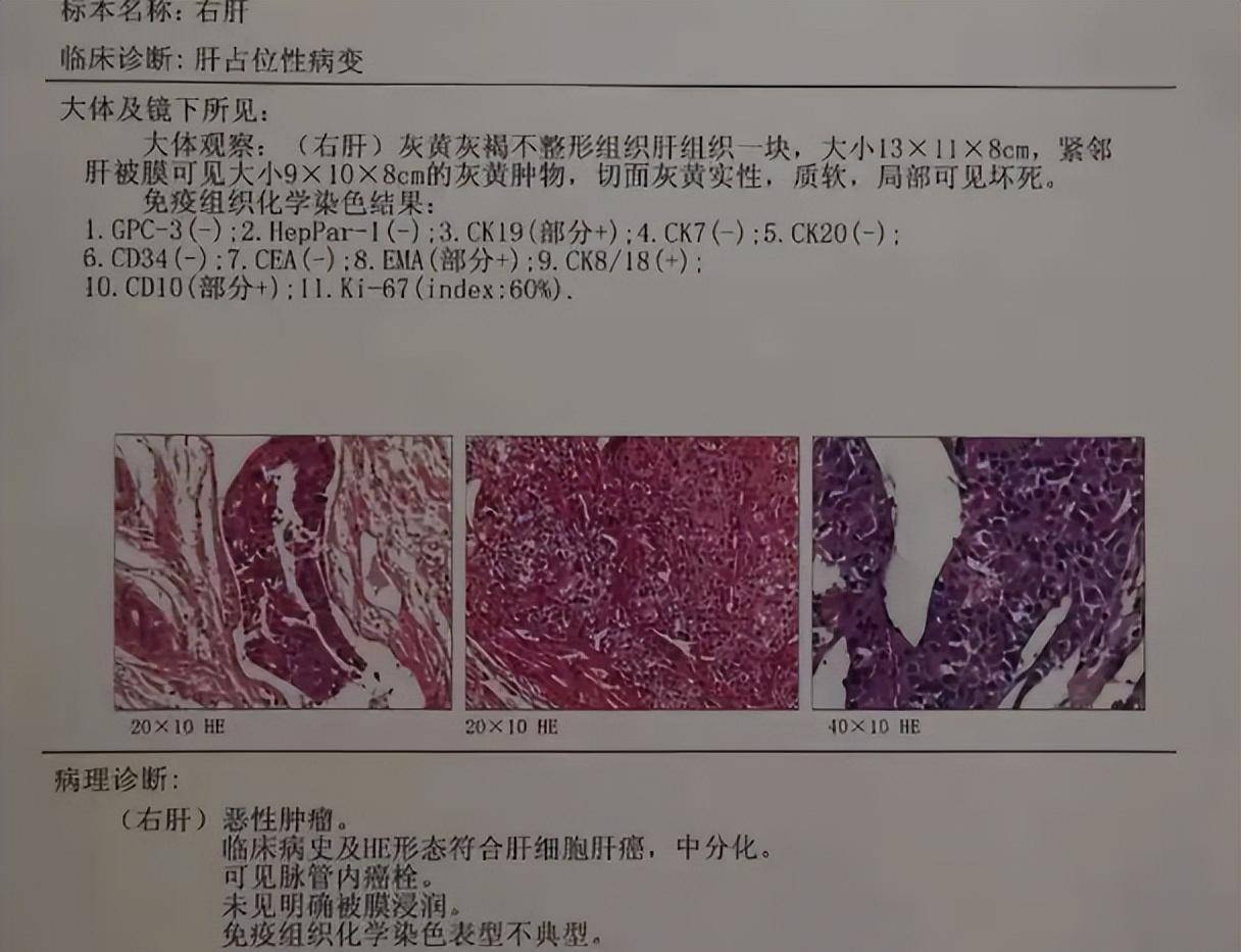 包含地坛医院住院办理陪诊挂号化验单专业解读，清楚了解病情的词条