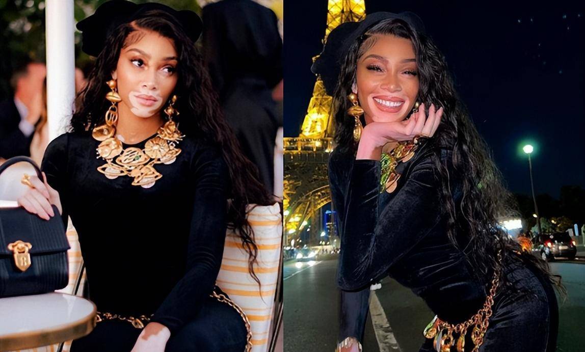 库兹马女友晒自拍:大腿上有白点!