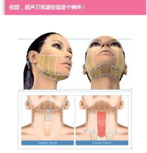 超声炮的危害和副作用、反容貌焦虑图鉴-超声炮的功效