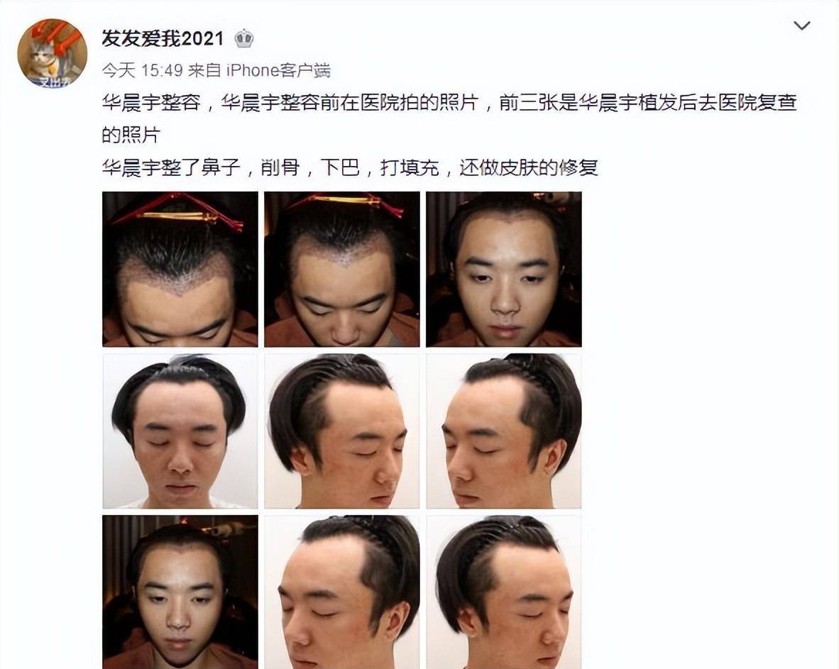 八卦整容最失败的女明星