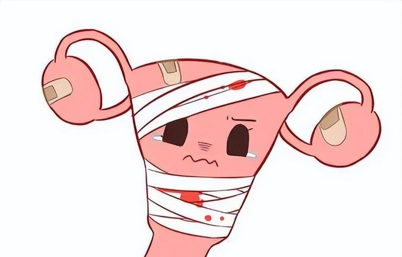 阴道为什么出血