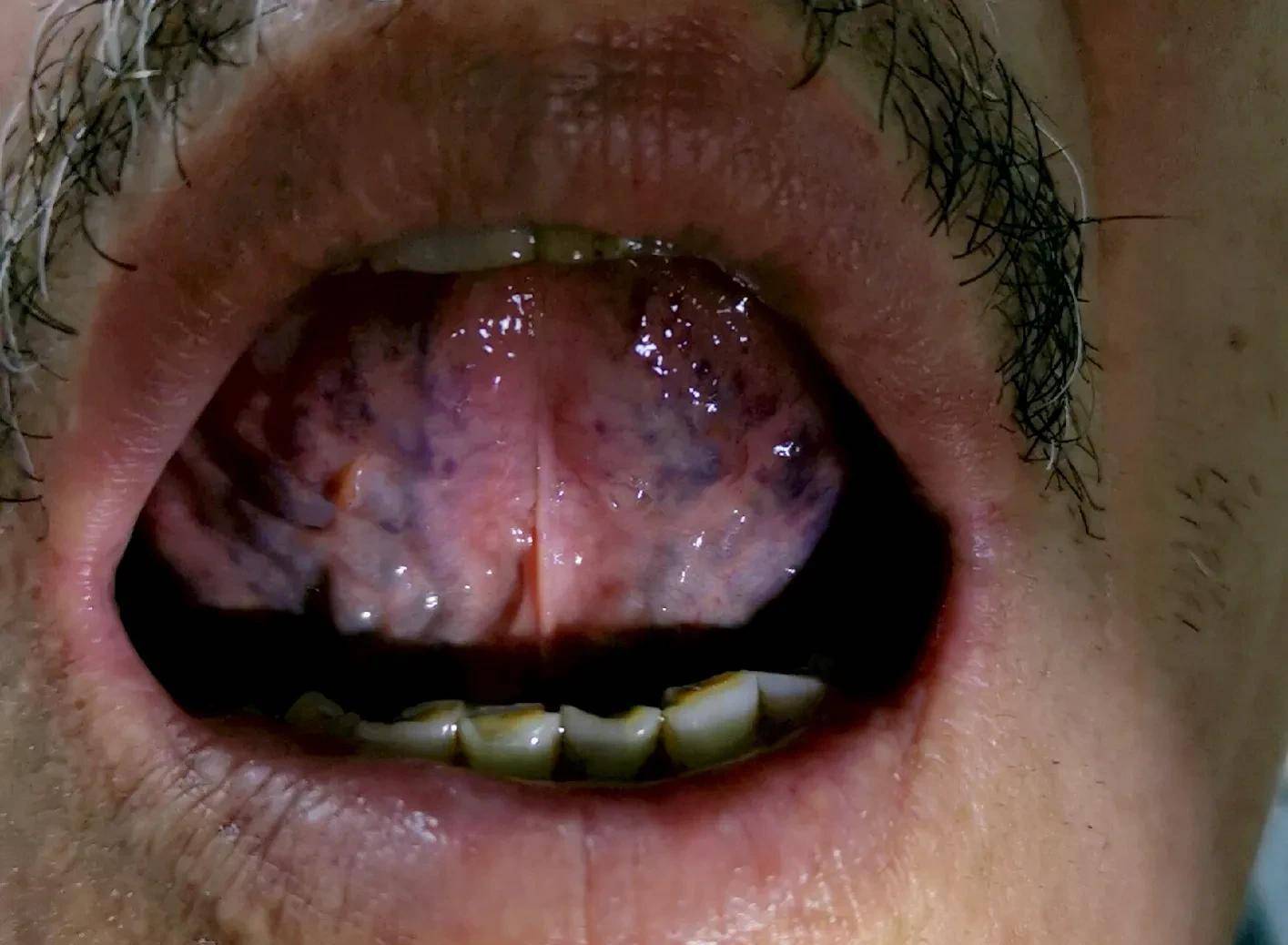 但由于药味配伍精当,适应症非常广泛,急慢性胆囊炎,便秘,失眠,色斑