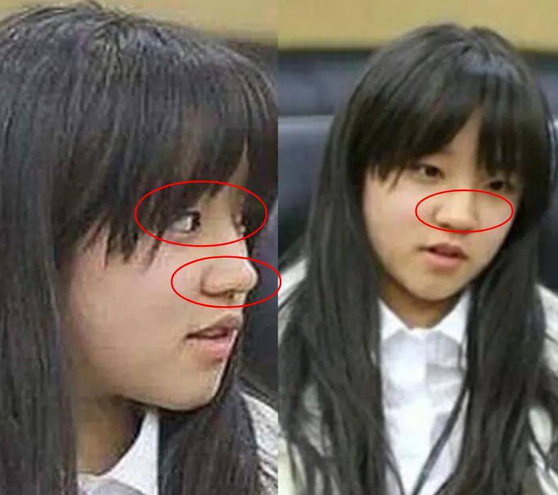 宋雨琦出道前照片流出,看清她怼脸拍后:医生号码麻烦给我一下?