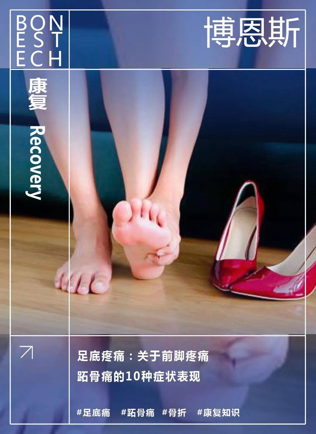 足底疼痛:关于跖骨痛,前脚疼痛的10种症状表现_反应_治疗_脚掌