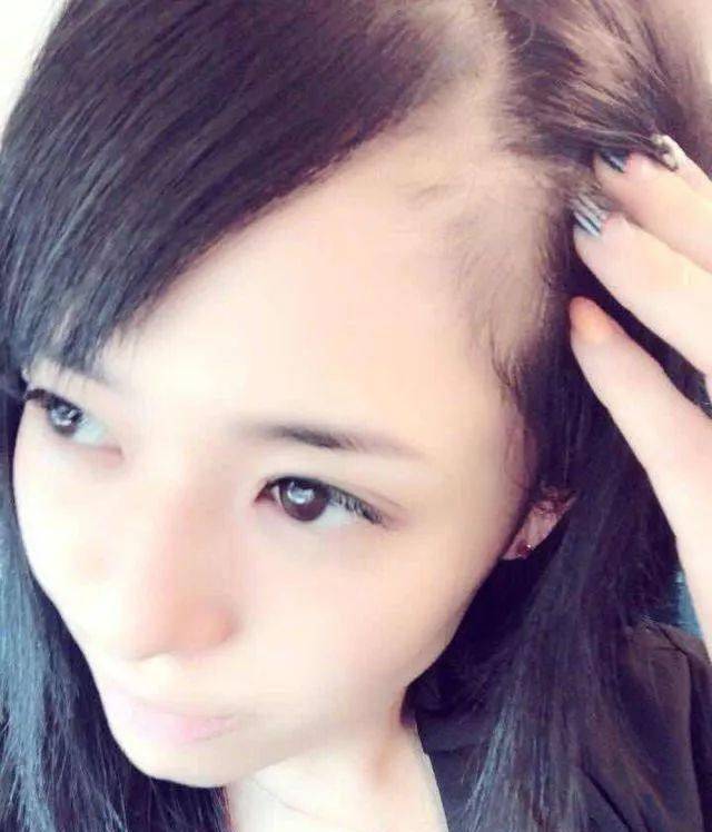 苍井空边看世界杯边晒照,发际线太高让人担心!粉丝:保重身体!