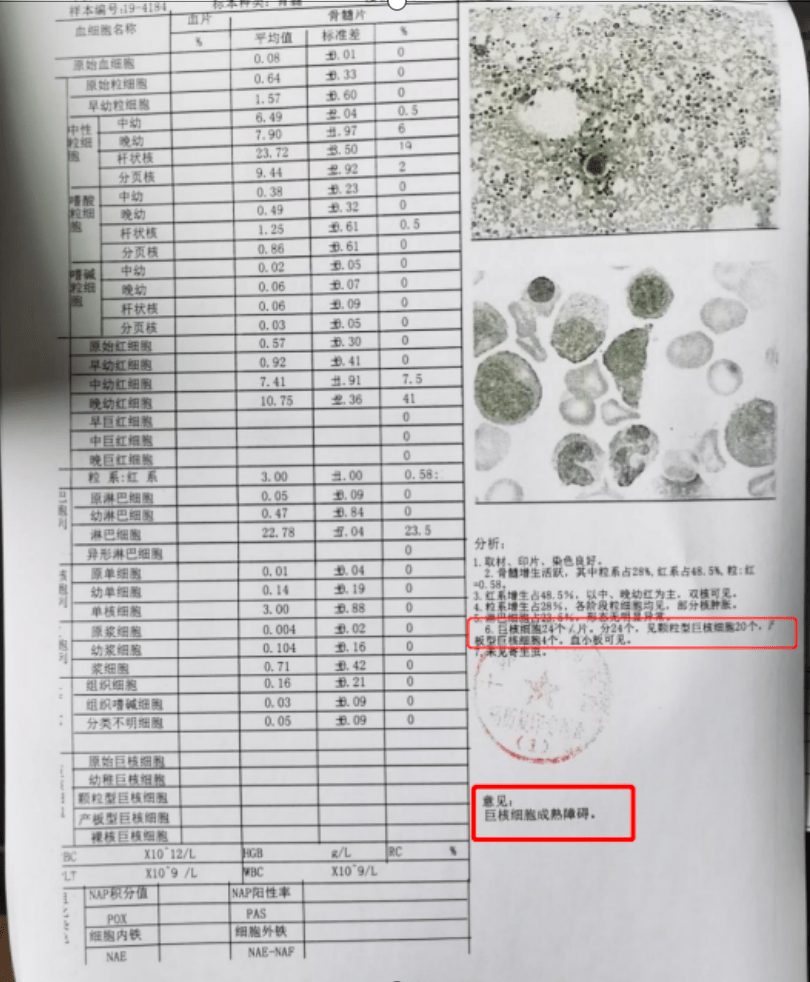 骨穿报告单图片图片