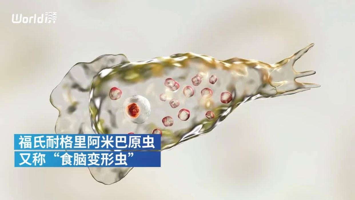 食脑寄生虫图片