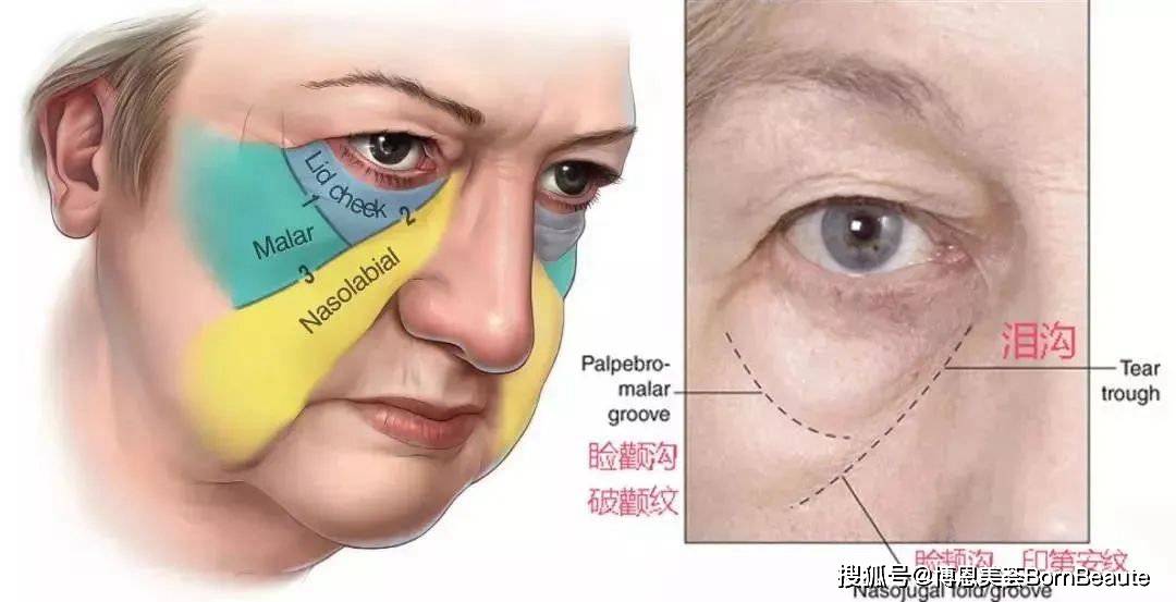 你的印第安纹是什么类型?不同解决方案整理,建议收藏