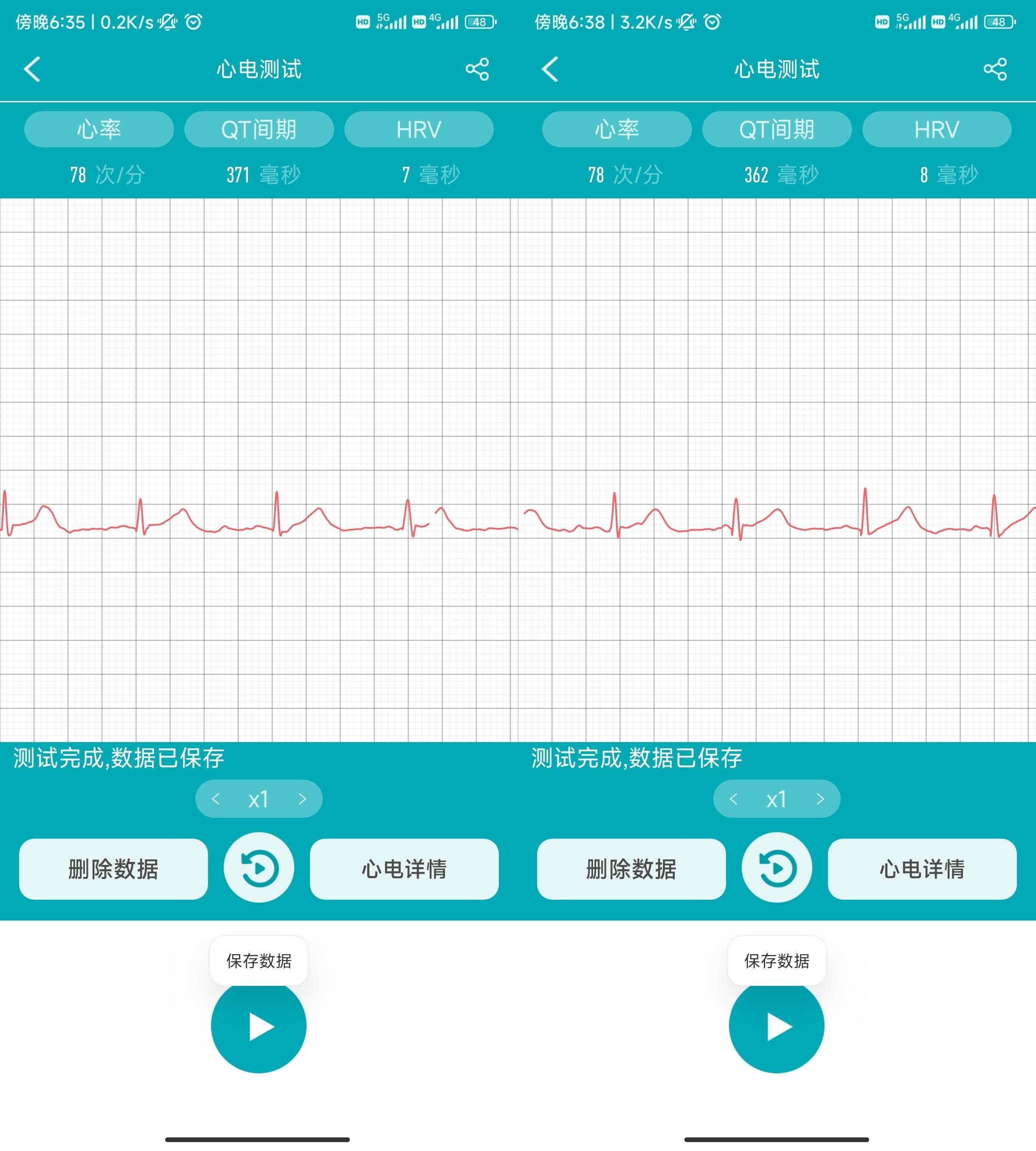 快节奏生活的守护者:dido e56 max智能手表,时尚又健康_监测_功能