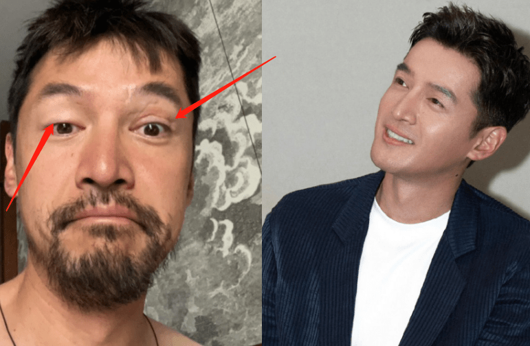 照片中,胡歌很颓废,胡子拉碴像个流浪汉,眼睛上的疤痕非常明显,似乎是