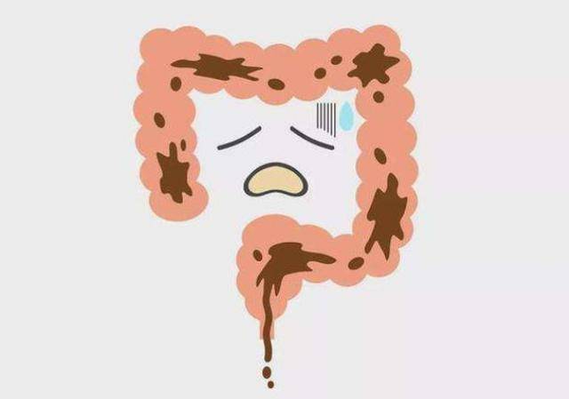 大便"前头干硬,后边软粘"?可能是3种原因很多人没意识到