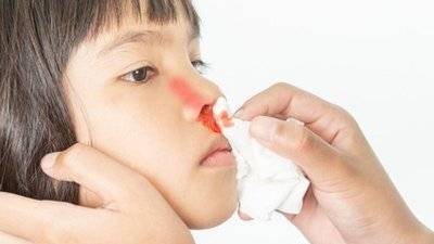 孩子流鼻血是什么原因导致的(孩子流鼻血时怎么处理)