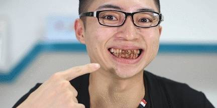 饭后食物塞牙缝,牙齿上有菜叶,尴尬又难受,你是怎么解决的呢?