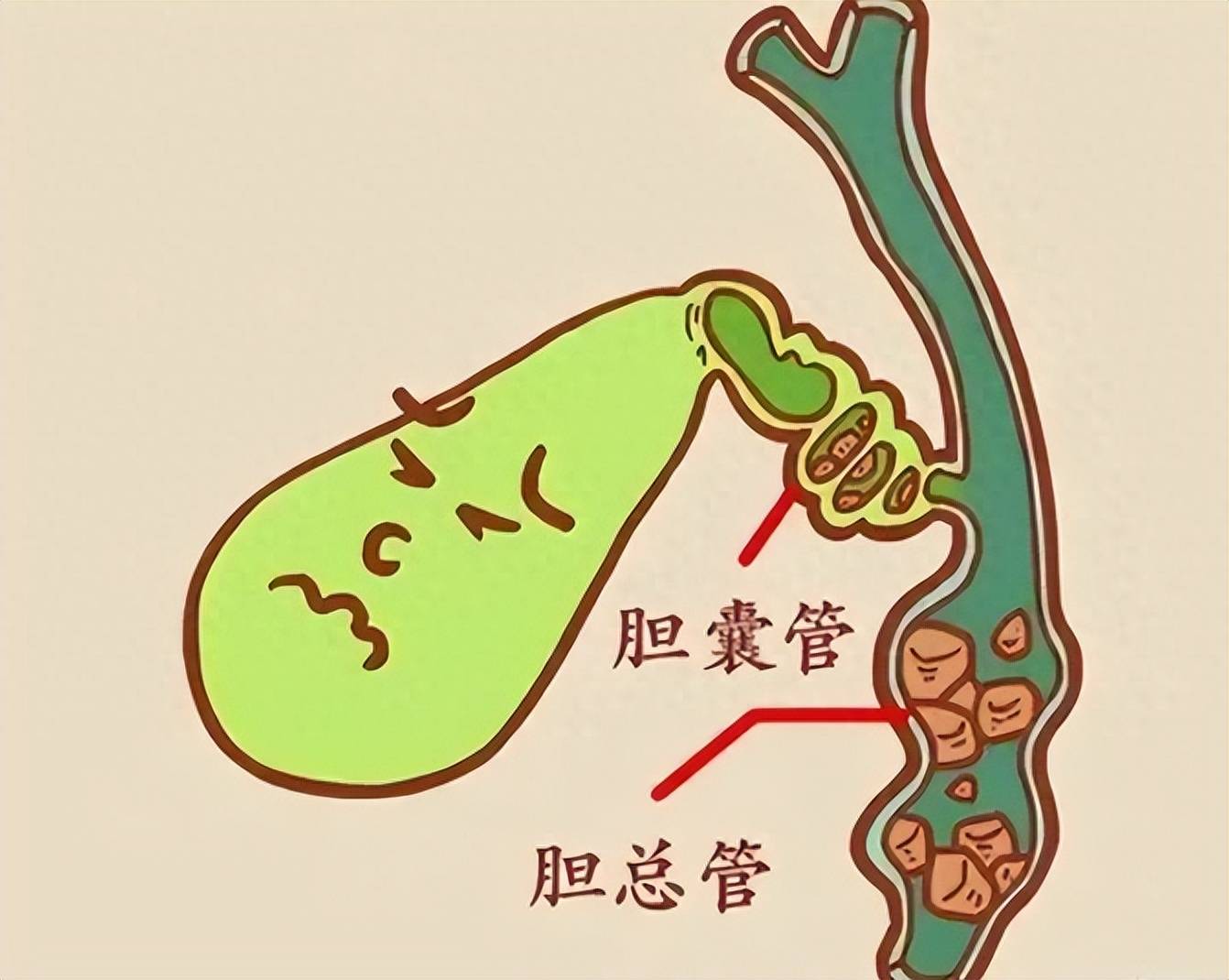 胆囊漫画图片图片