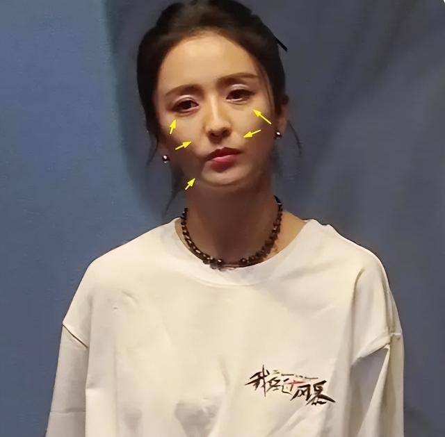 对此,有些网友晒出了佟丽娅的修图和生图,进行对比.