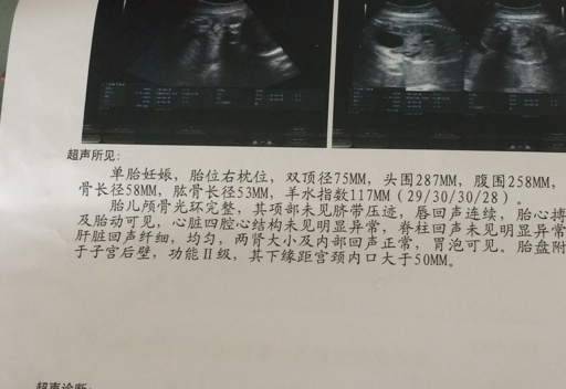 产检时,b超单上3个"数值",或许暗藏宝宝"性别"的小秘密哦!