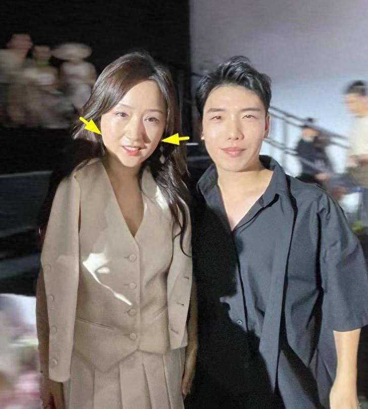 52岁杨钰莹出席时装周,手上拎着20万包,衣着华丽,脸肿得面目全非_网友