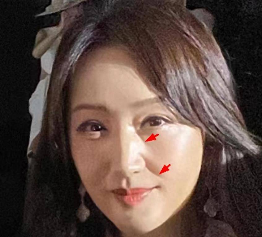 52岁杨钰莹出席时装周,手上拎着20万包,衣着华丽,脸肿得面目全非_网友