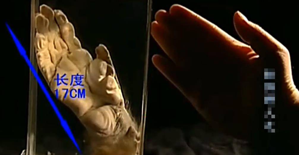 2010年,浙江校园发现"野人"手足标本,专家深入调查揭开真相_周寿_村民