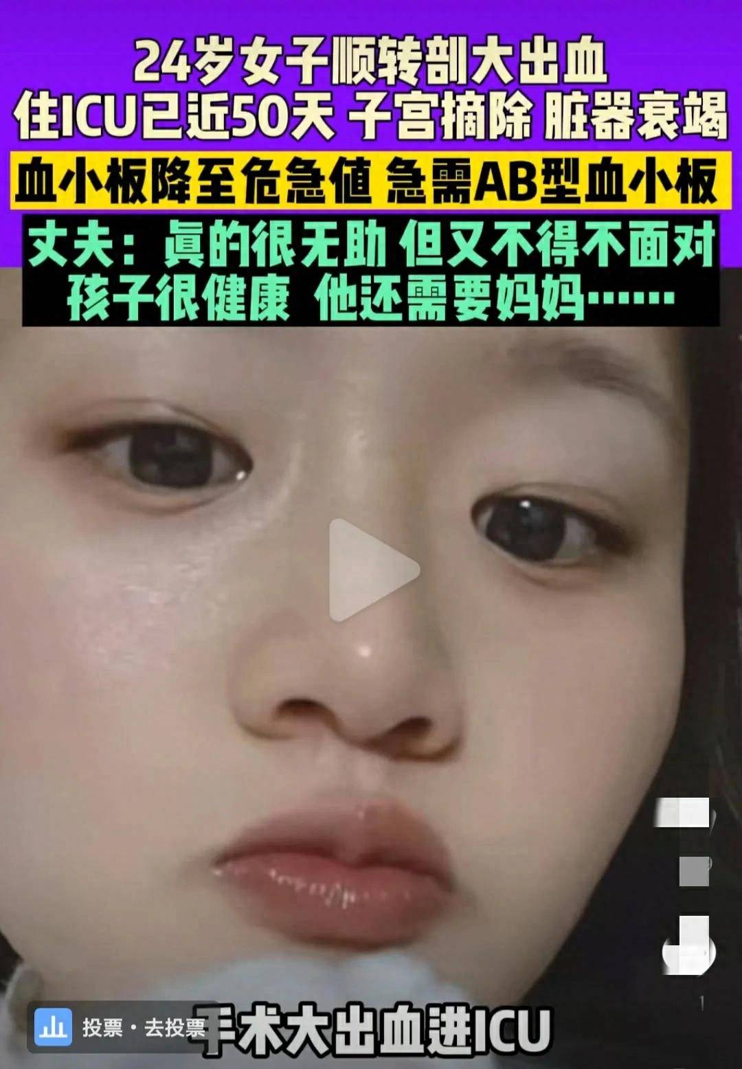 妻子生产并发生严重并发症,丈夫呼吁捐献ab型血小板_先生_生命_时间